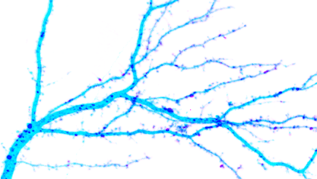The image shows dendrites (light blue) in the hippocampus, a part of the brain involved in learning and memory. These dendrites provide special proteins (purple dots) needed for synapse function.