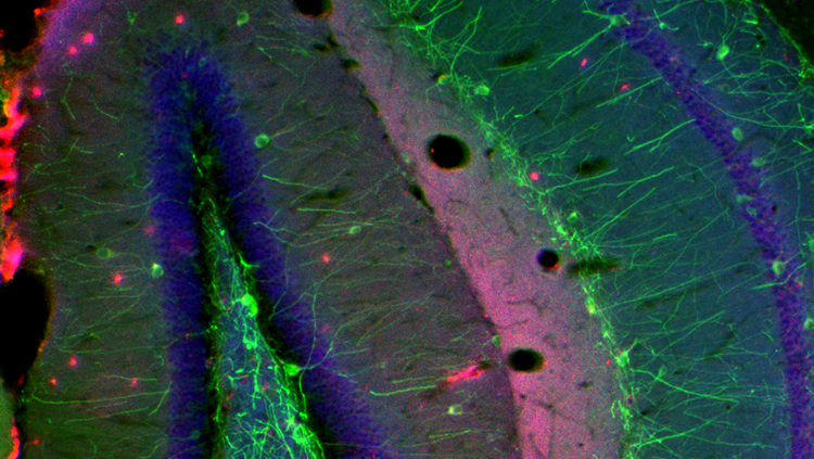 Image of neurons in synapse locations